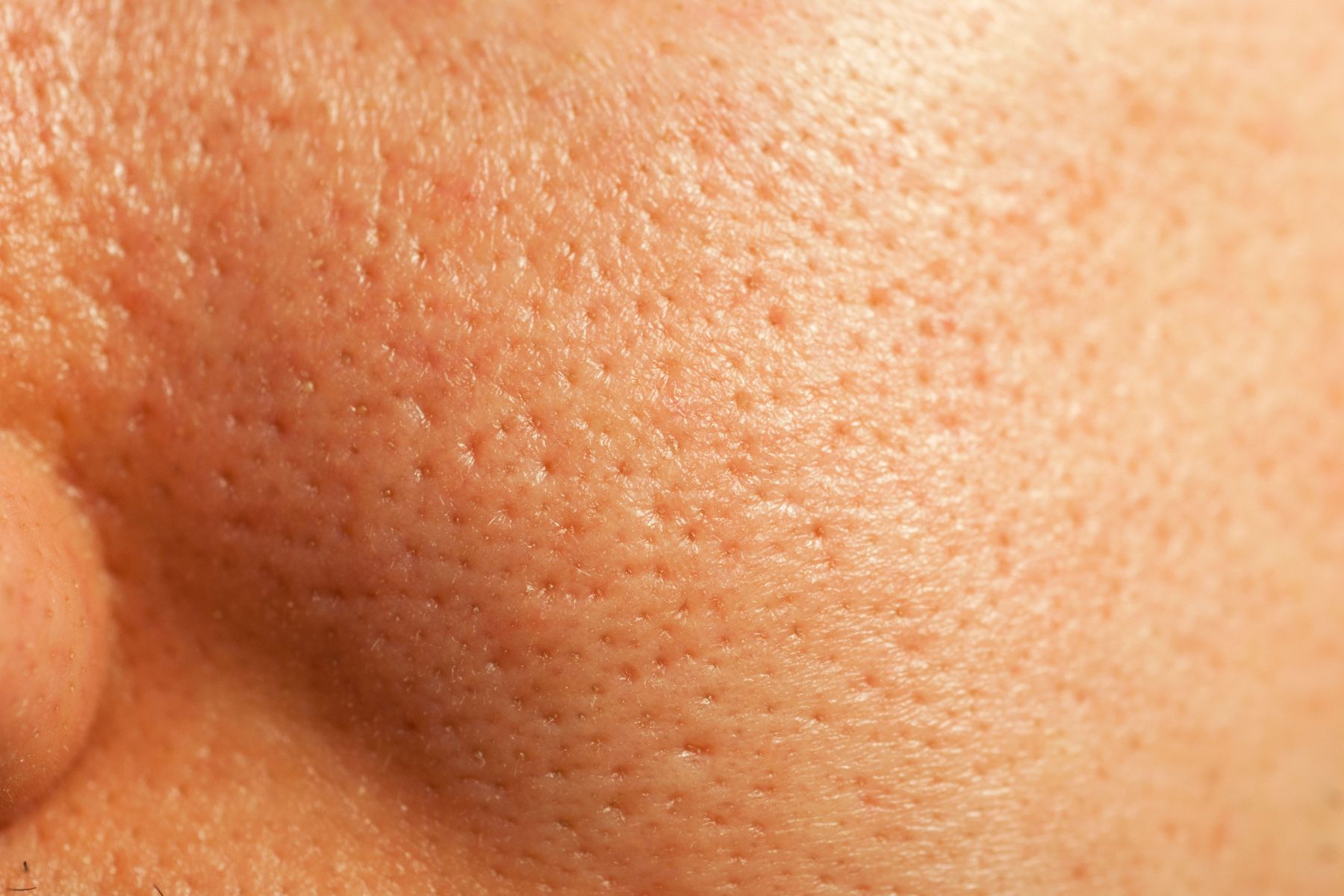 This Is Why Your Pores Look So Noticeable